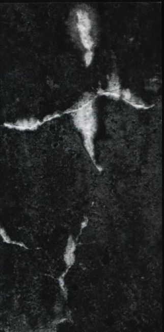 Neklid oka - ze závratí